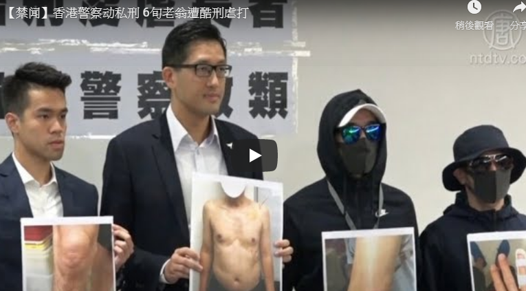 【禁闻】香港警察动私刑 6旬老翁遭酷刑虐打