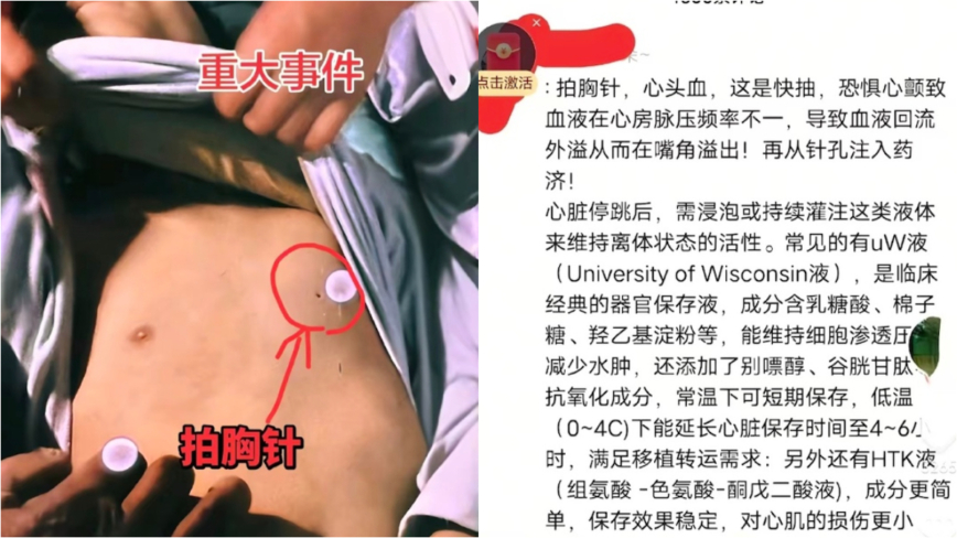 河南中学生死亡涉盗取器官？官方通报惹广泛质疑